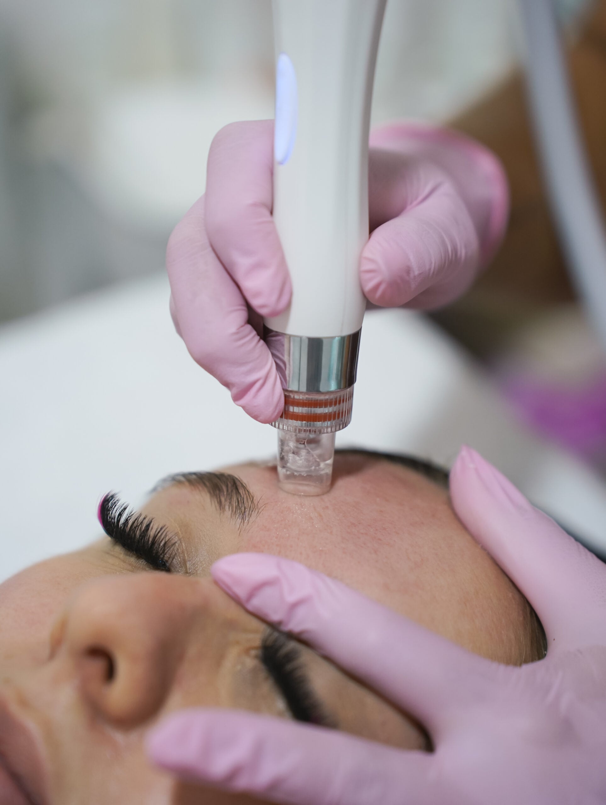 Limpieza avanzada con succión y exfoliación profunda que hidrata intensamente, dejando tu piel fresca, luminosa y rejuvenecida.