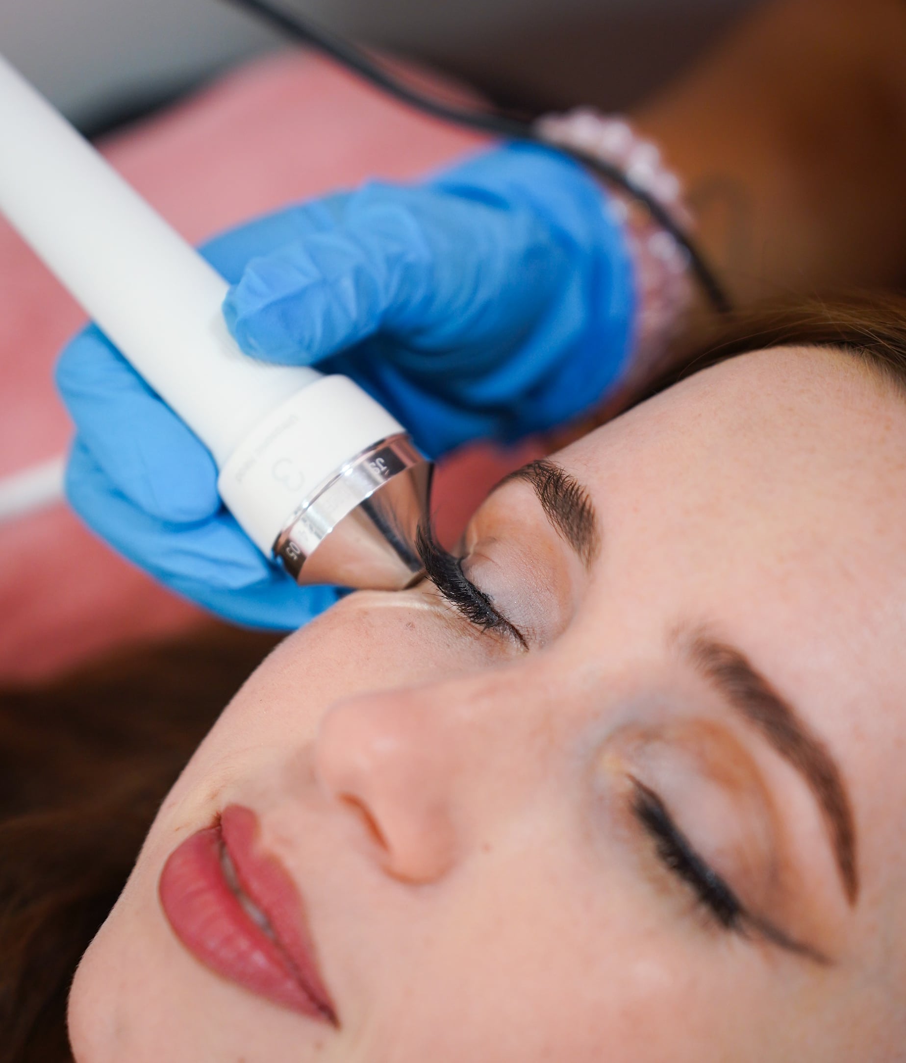 Tratamiento intensivo para bolsas, ojeras y firmeza del contorno de ojos, logrando una mirada más descansada y rejuvenecida.